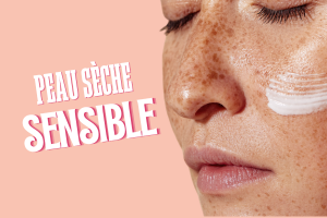 peau seche et sensible